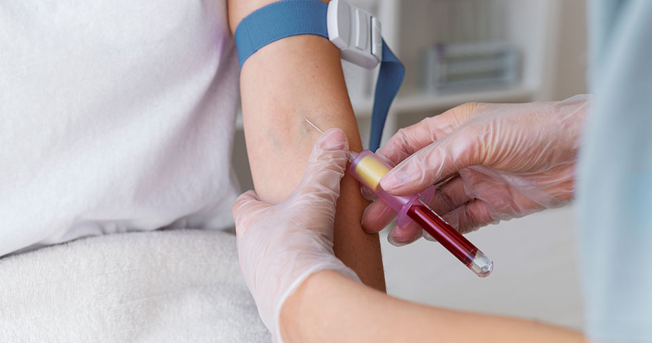 Esami del sangue: perché sono così importanti?