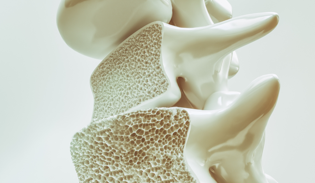 Osteoporosi: quali esami sono necessari per identificarla?