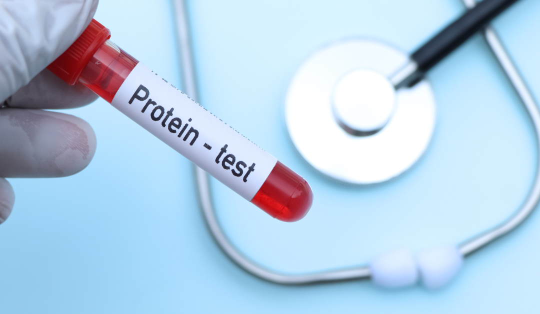 Concentrazione di proteine nel sangue: cosa significa?