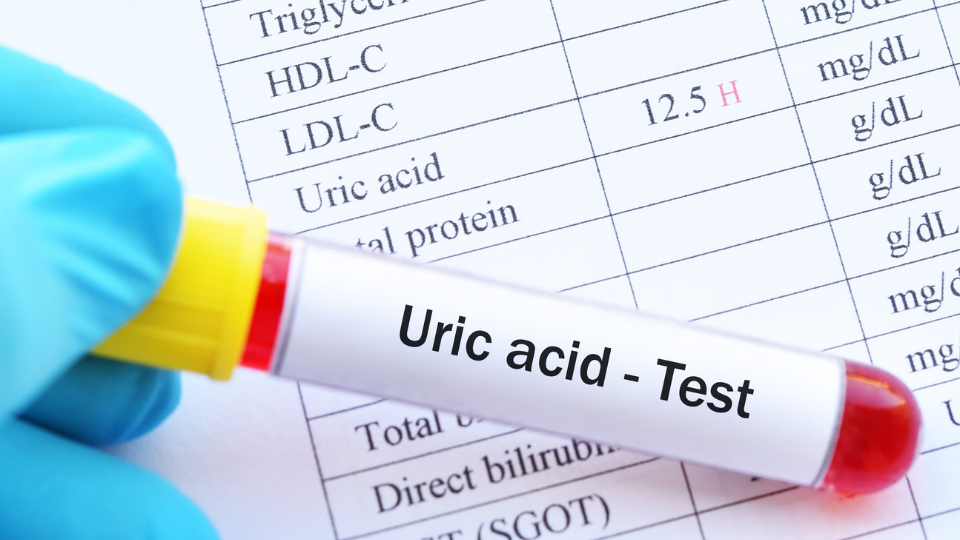 Acido urico: cos’è e quali sono i rischi di livelli elevati
