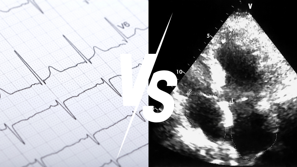 Elettrocardiogramma vs ecocardiogramma: strumenti vitali nella diagnosi cardiaca