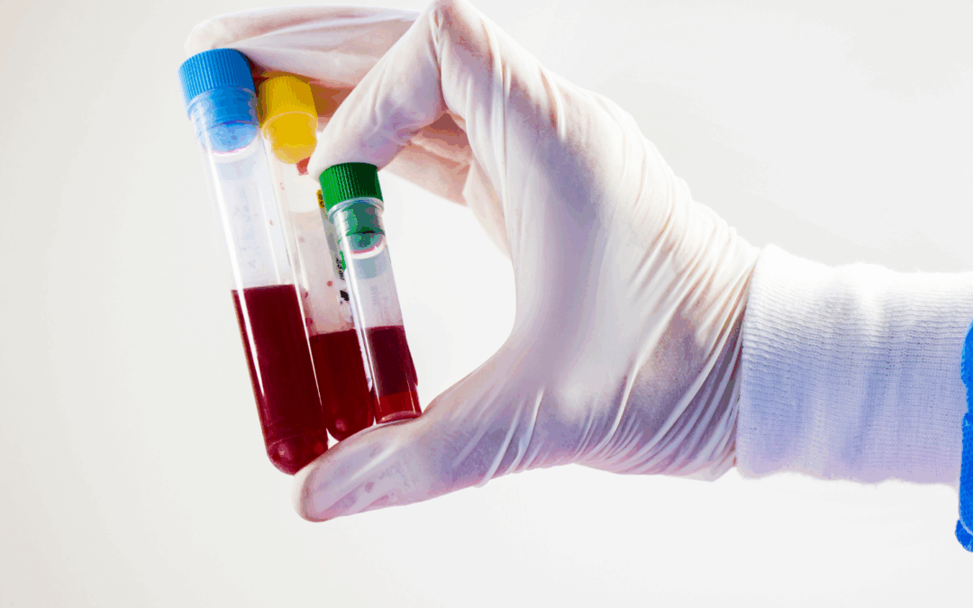 Esami del sangue dopo l’estate: quali valori può avere senso ricontrollare a settembre